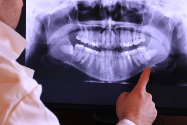 Urgent Tooth Repair in SC
